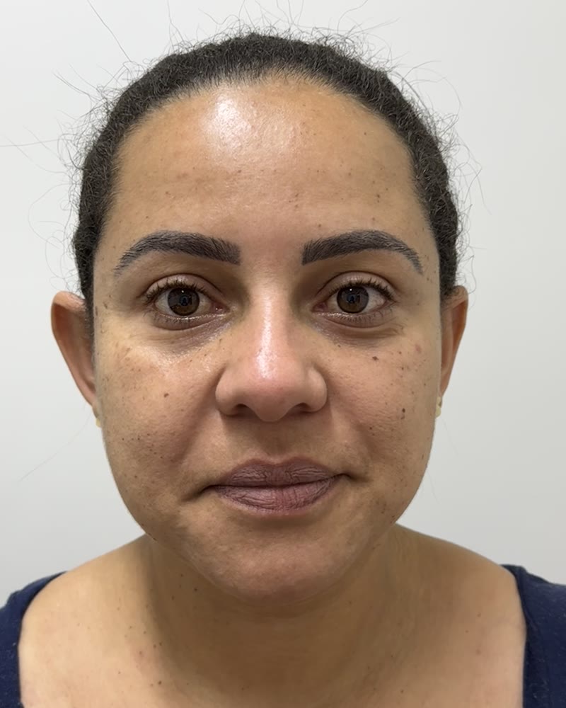Michele — registro frontal da pele